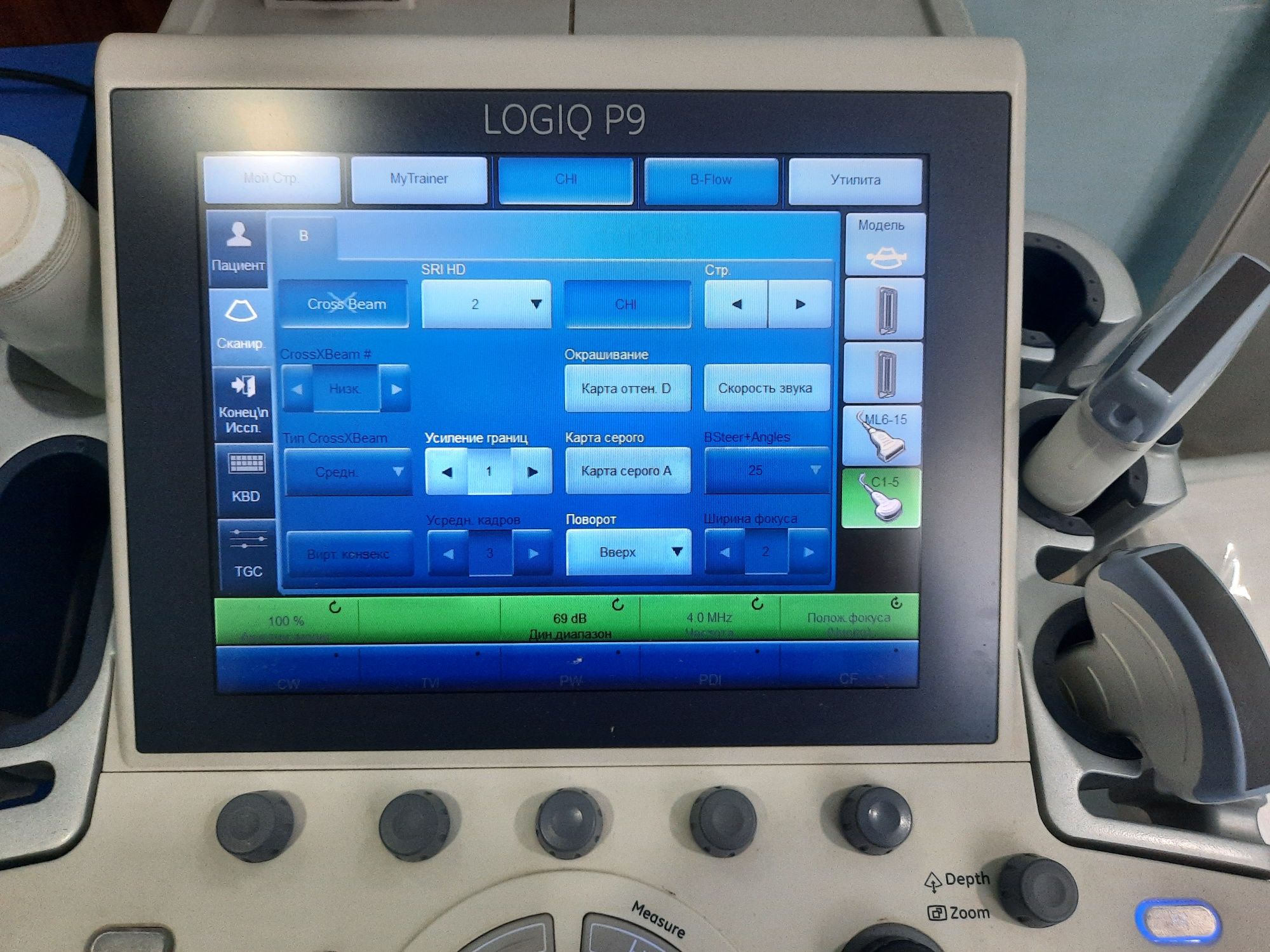 GE LOGIQ P9 ultrasound