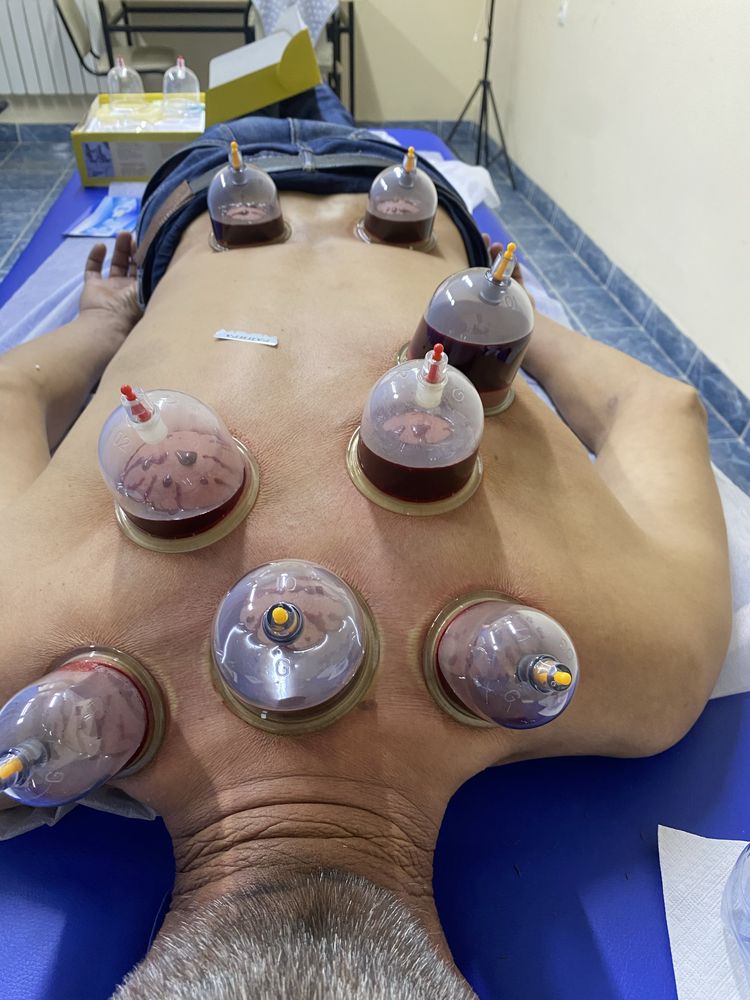 Hijama тек Индивидуальный банкалармен