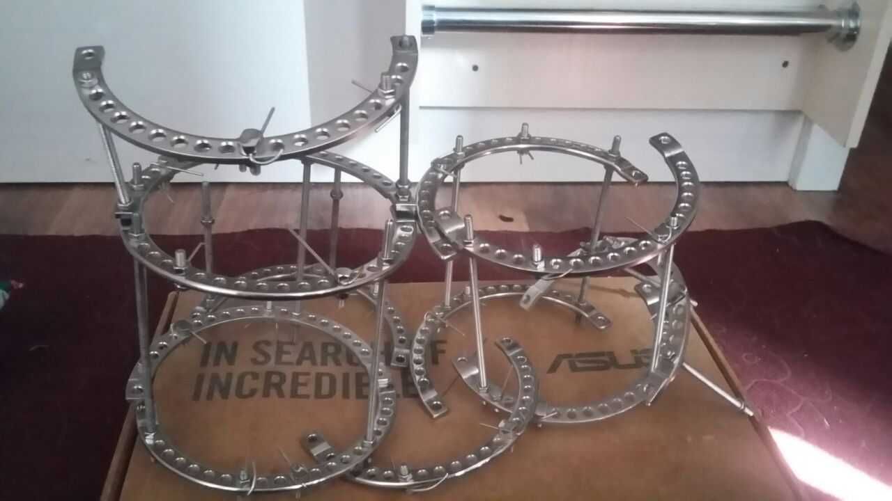 аппарат илизарова