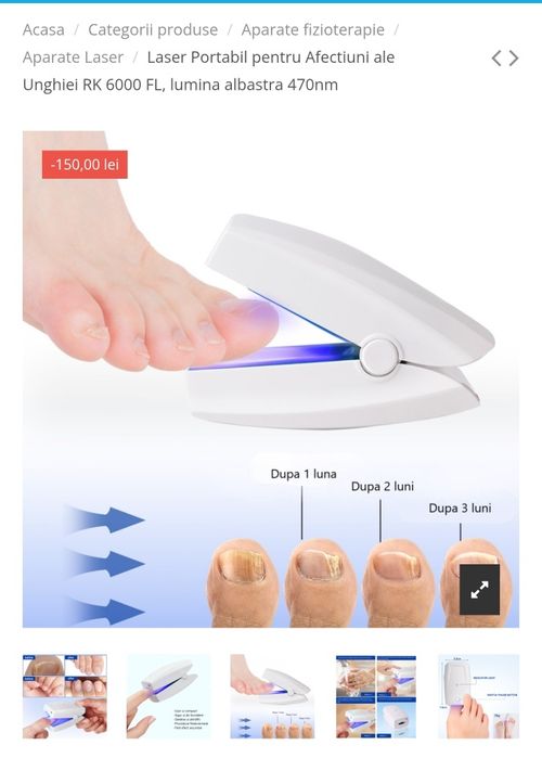 Aparat cu laser pentru afectiuni ale Unghiei RK6000FL, lumina albastră