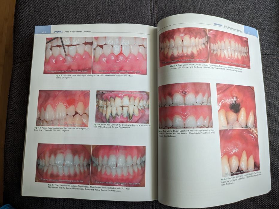 Clinical Periodontology - negociabil