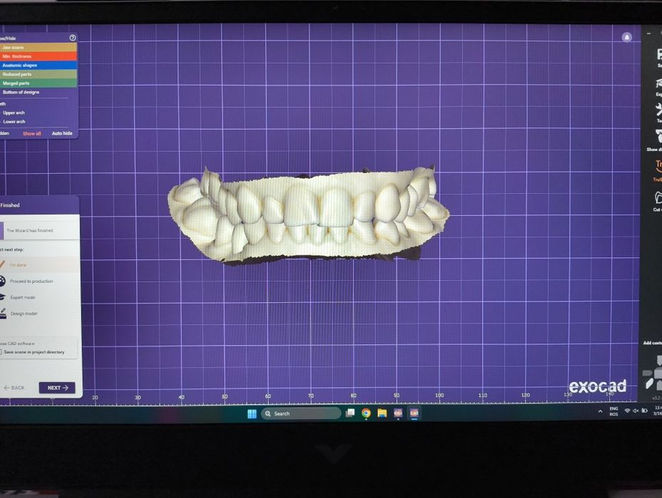 HP tehnică dentară