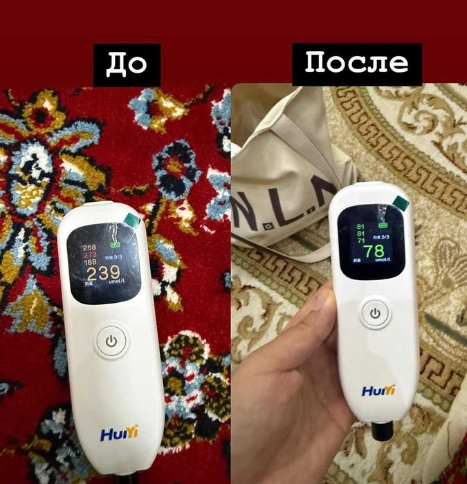 Fotolampa fototerapiya ot jeltuxi v arendu na dom