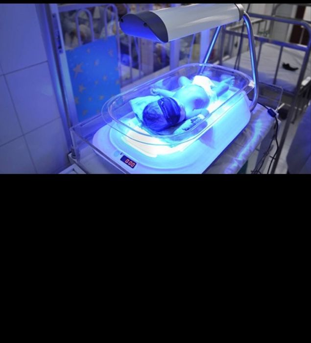 Fotolampa, chaqaloqlardagi sariqlikni uyda davolaymiz