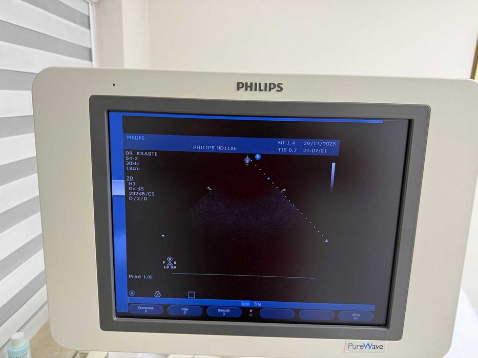 ехограф - кардиологичен Philips HD11 XE
