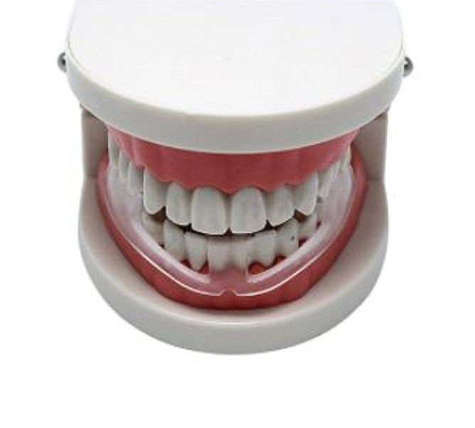 Капа стоматологическая от бруксизма (ночного сжимания зубов)