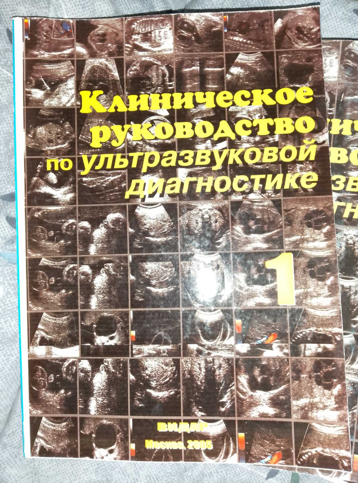 Книги по УЗИ Митькова
