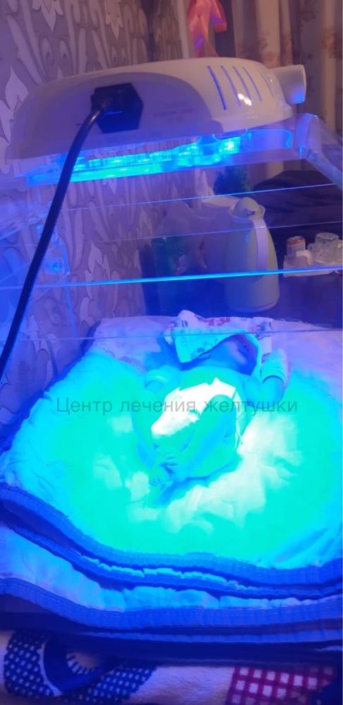 Фотолампа для новорожденных