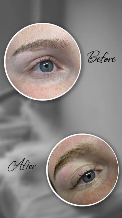 Pensat, laminare gene & sprancene