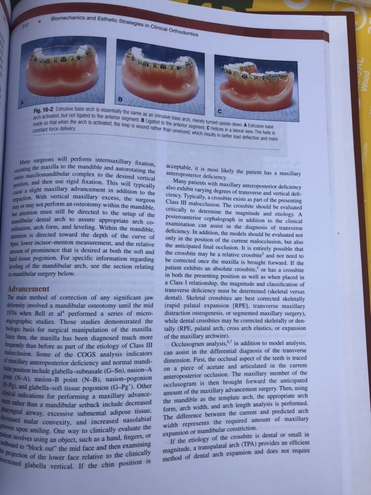 Biomechanics and Esthetics Strategies in Clinical Orthodontics NANDA