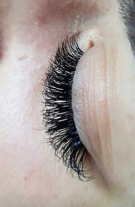 Aplicare Extensii de Gene