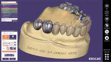 Exocad 3.2 Elefsina Full + PartialCad 3.3 Chemnitz + 357 libraries