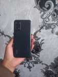 Redmi note 11 aybi faqat sensor almashgan