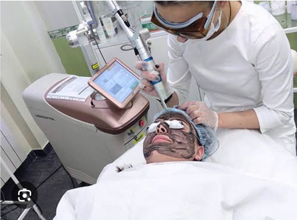 Карбоновый пилинг лица.