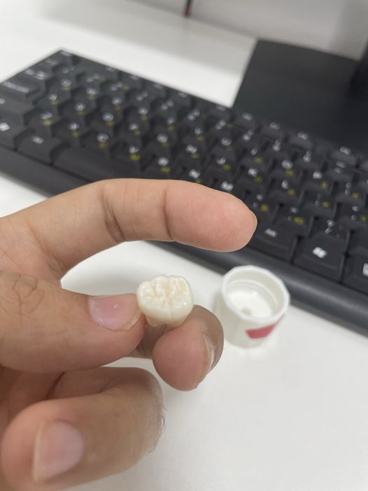 Зубы,зуб мудрости