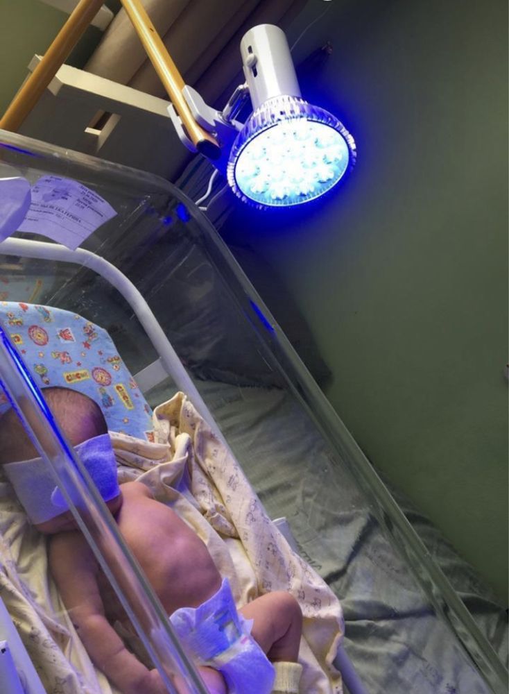 Фотолампа от желтушки у новорожденных малышей ( повышенный билирубин)