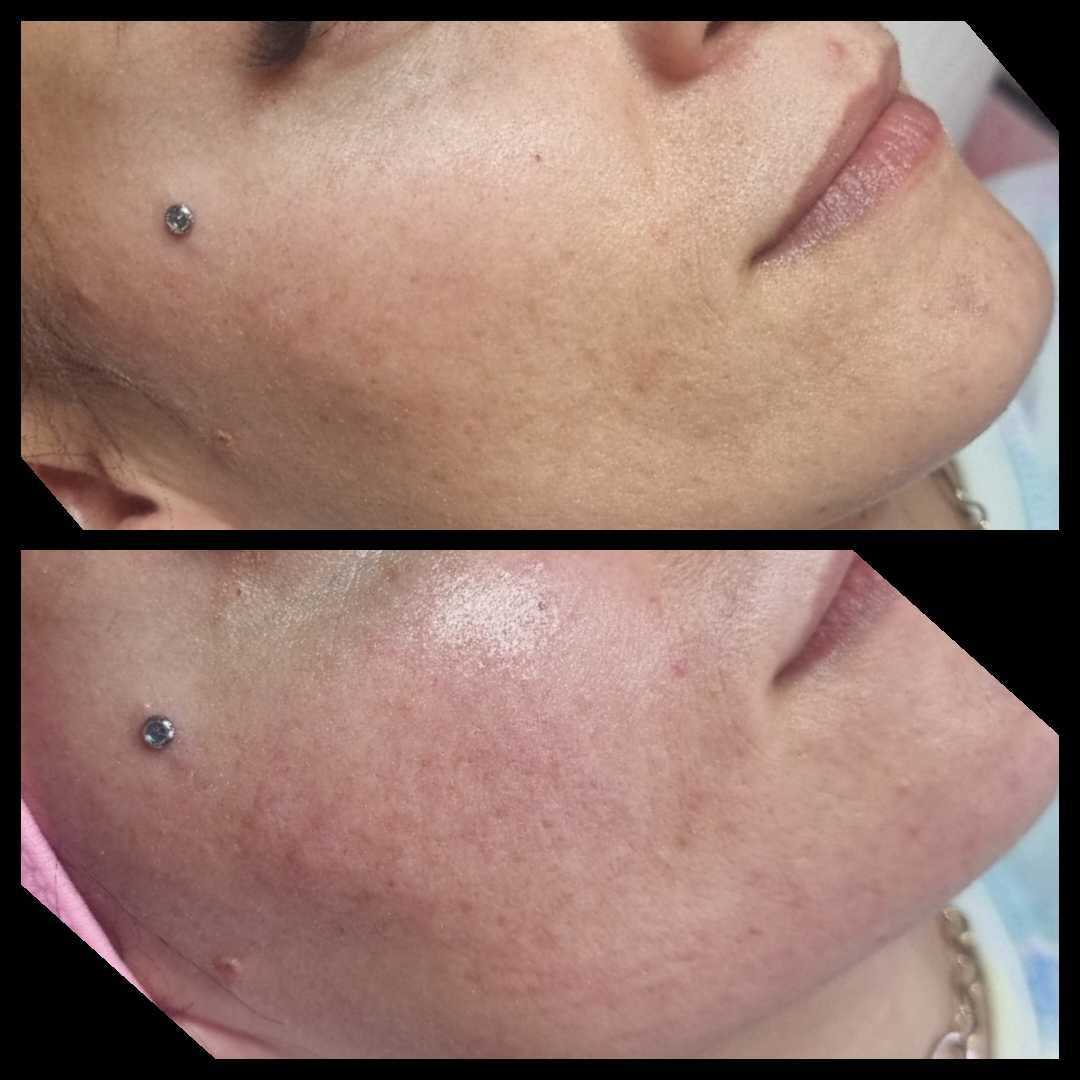 Cosmetica  / Pensat