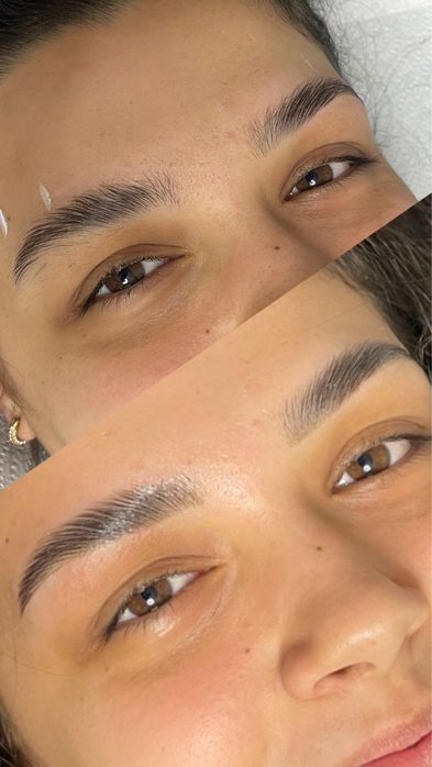 Aplicare extensii gene( tehnica one by one)