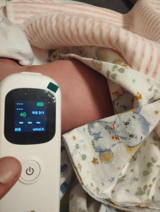 Fotolampa fototerapiya ot jeltuxi v arendu na dom