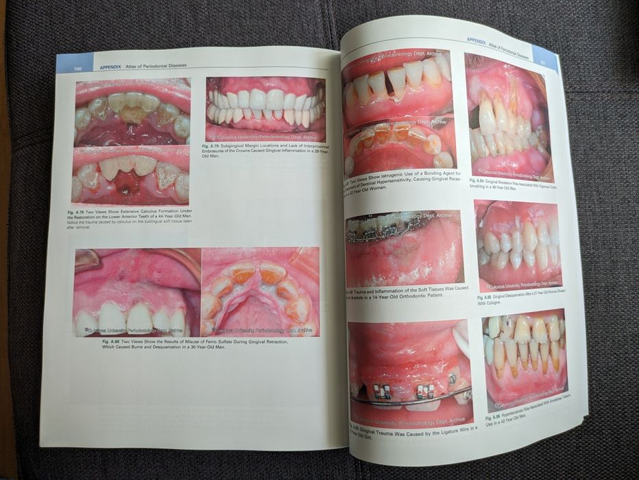 Clinical Periodontology - negociabil