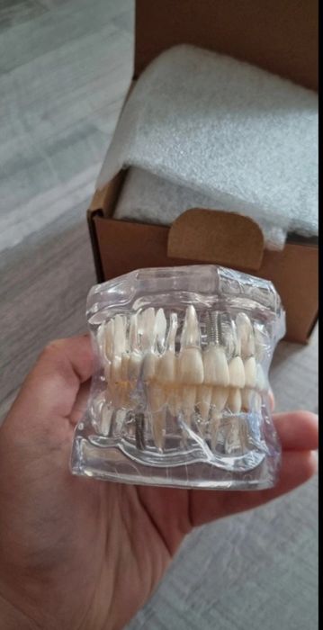 Model dentar multiple patologii