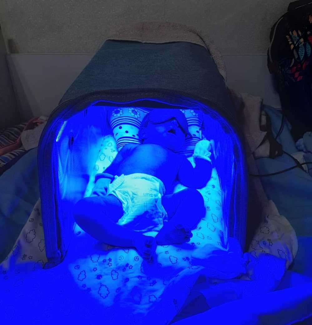Фотолампа от желтухи у новорожденных.Билитест.Фототерапия