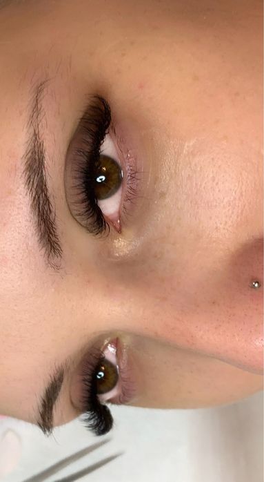 Extensii de gene - Timisoara