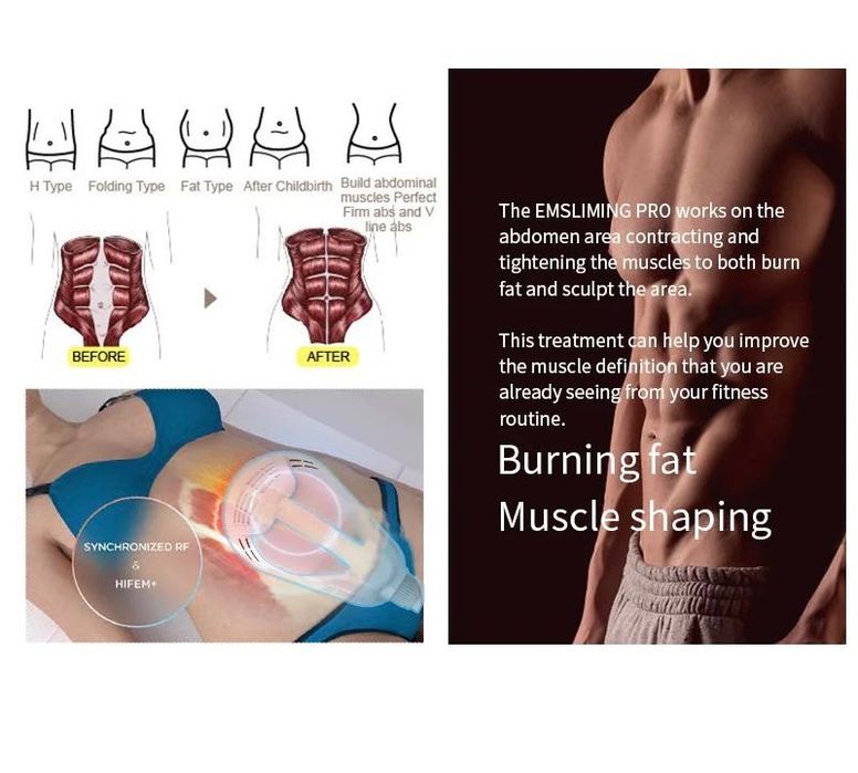 Уникален уред за тяло ! Hiemt