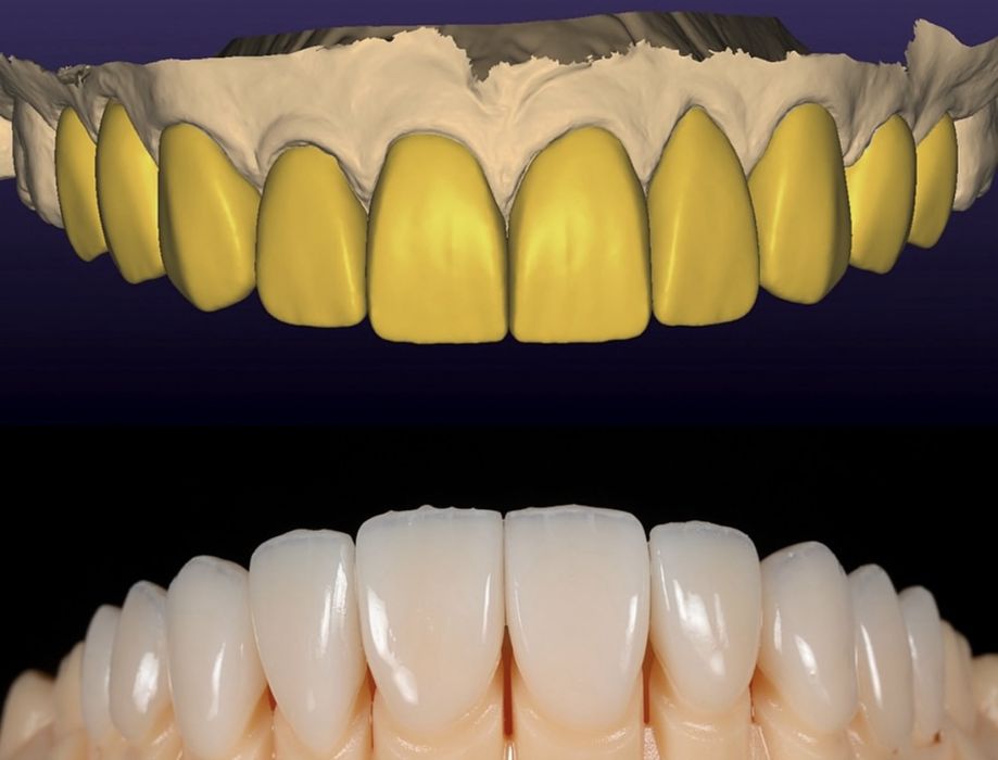 Colaborare Tehnician Dentar