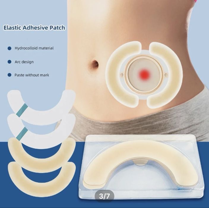 Уход за стомой в Ташкенте stomsi bor bemorlarga qarash