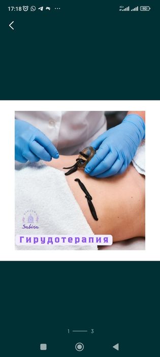 Пиявки.  Сүлік.    Гирудотерапия