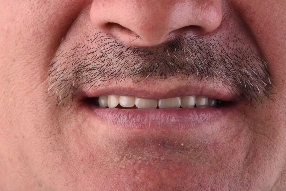 Зуботехническая Технология CAD/CAM в стоматологии