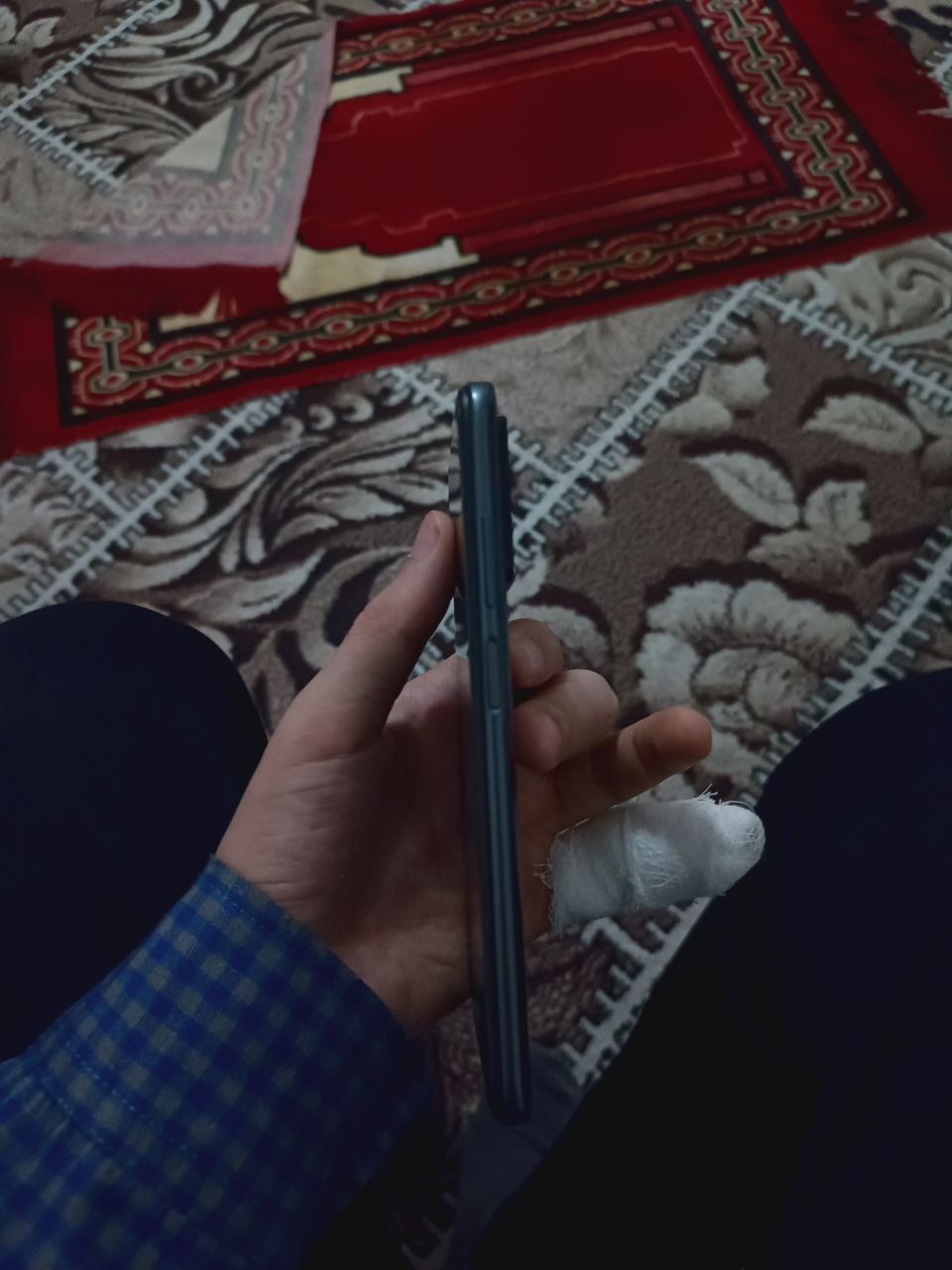 Redmi note 11 aybi yoʻq