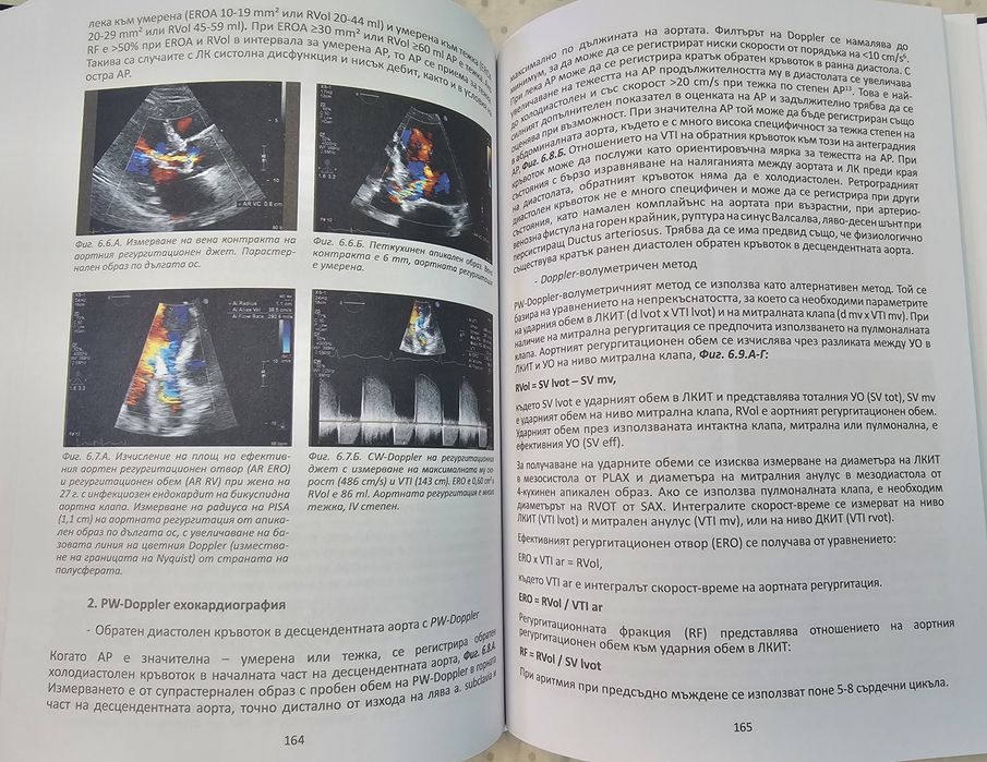Ръководство по ехокардиография