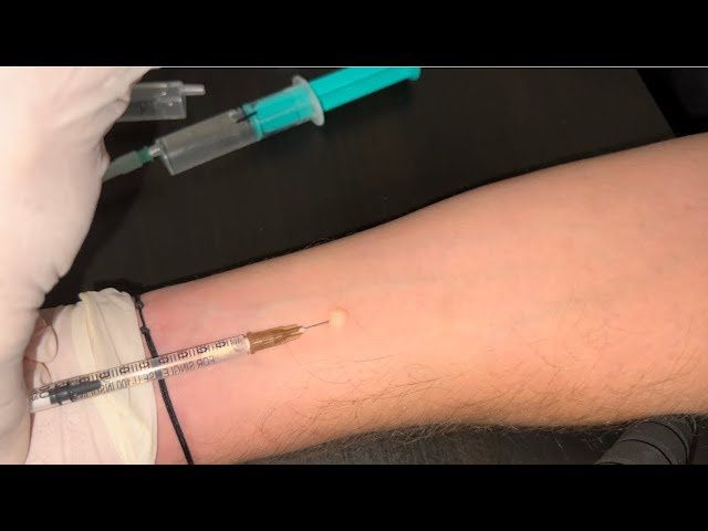 Asistență medicală ( la domiciliu )