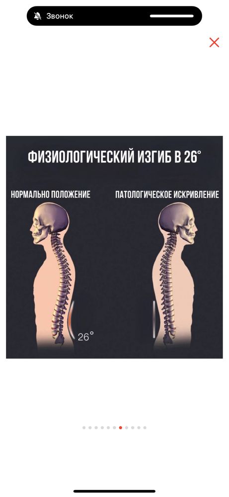 Массажёр на спину для осанки и от болей в спине