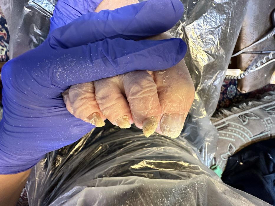 Медицинский педикюр от 10000