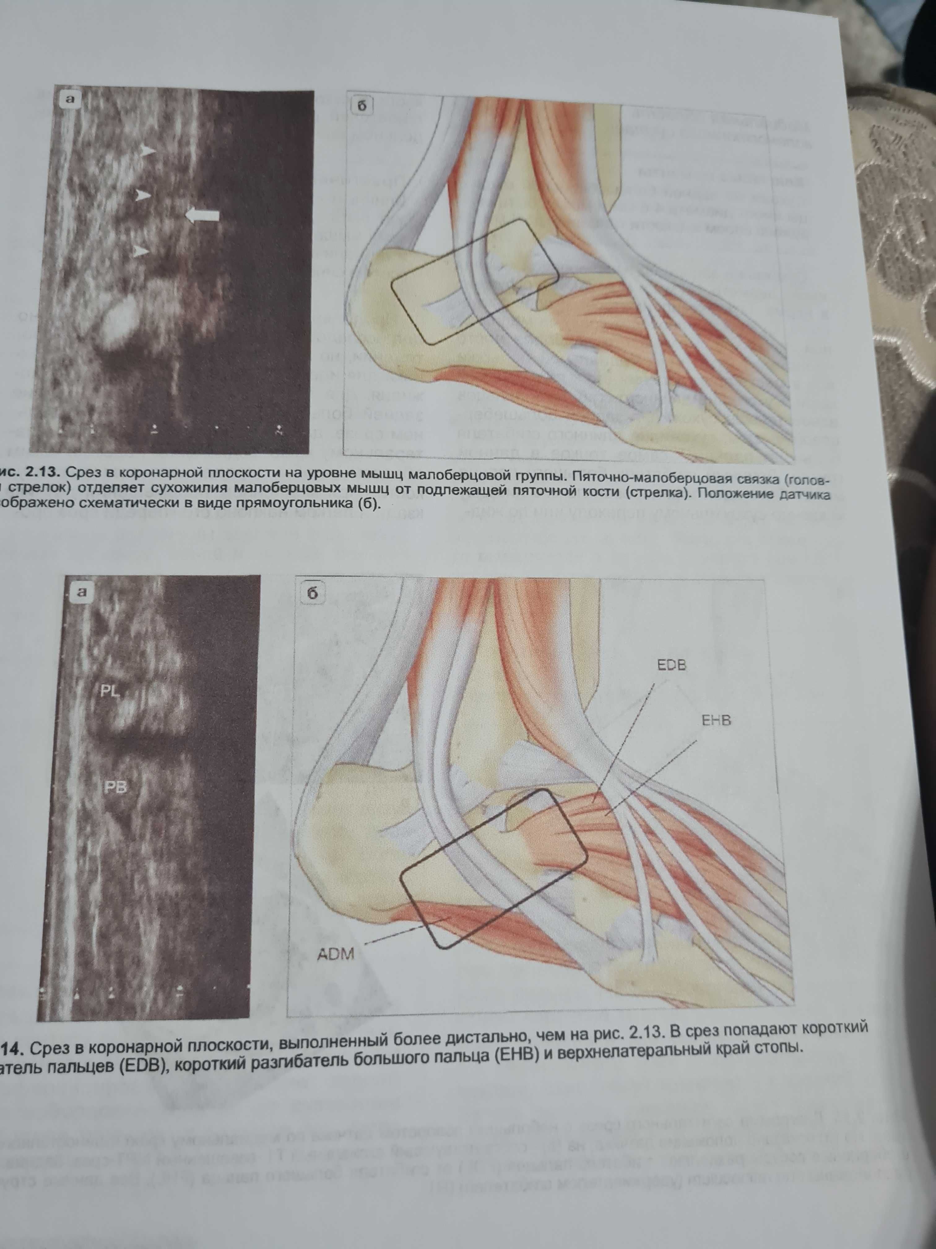 Ультразвуковые исследования костно-мышечной системы автор МакНелли