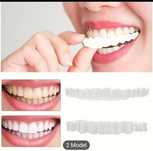 Set 2 fațete dentare
