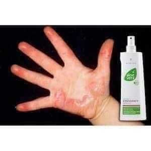 Aloe Vera Спрей за спешна помощ