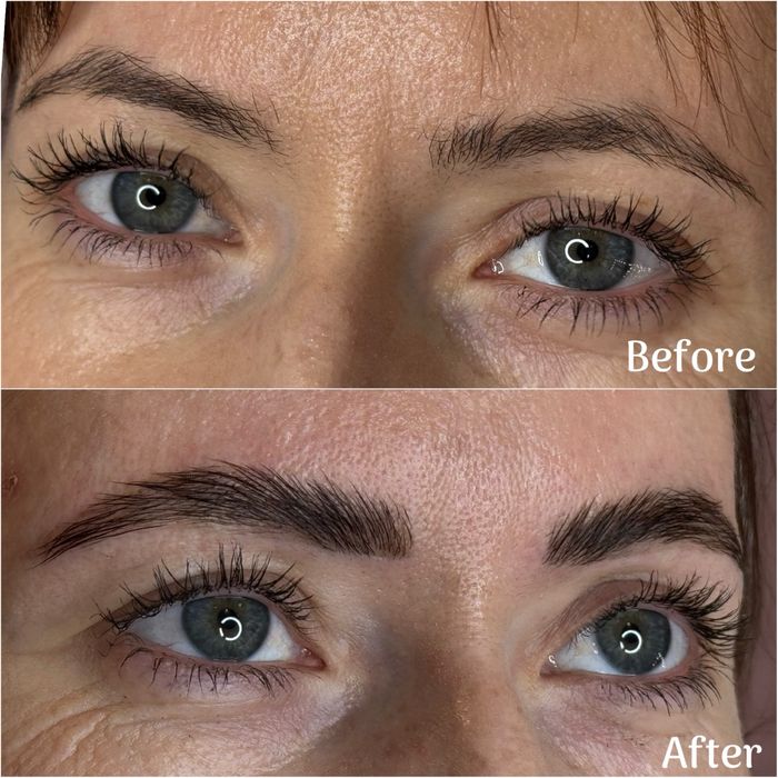 Laminare gene si sprancene