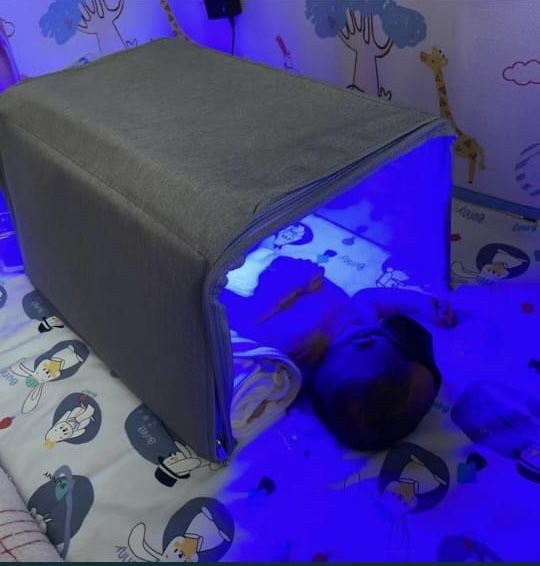 Фотолампа от желтухи для новорожденных.Билитест.Люлька