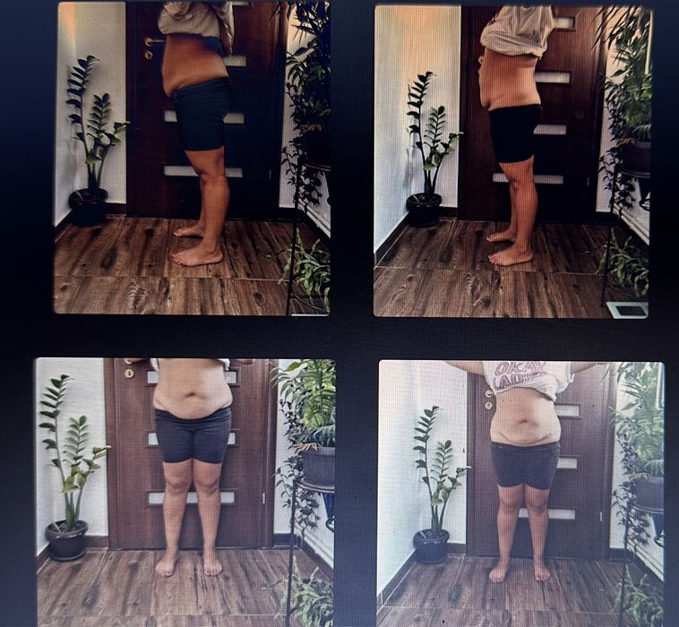 Liposonix oferta luna Ianuarie