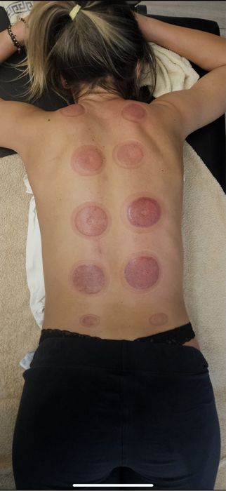 Masaj terapeutic 100 sau 65 de minute, Masaj anticelulitic 45 minute