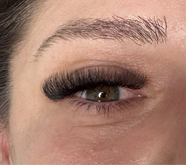 Aplic extensii gene 2/3/4D (colentina)