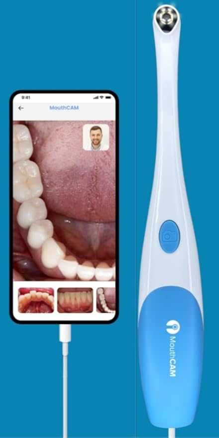 USB Дентална камера  MouthCAM