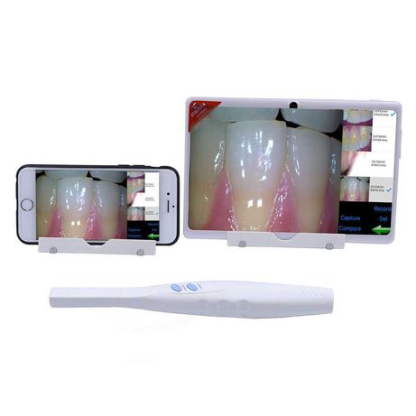 Интраоральная Wi-FI камера. Dental Camera Wi-Fi