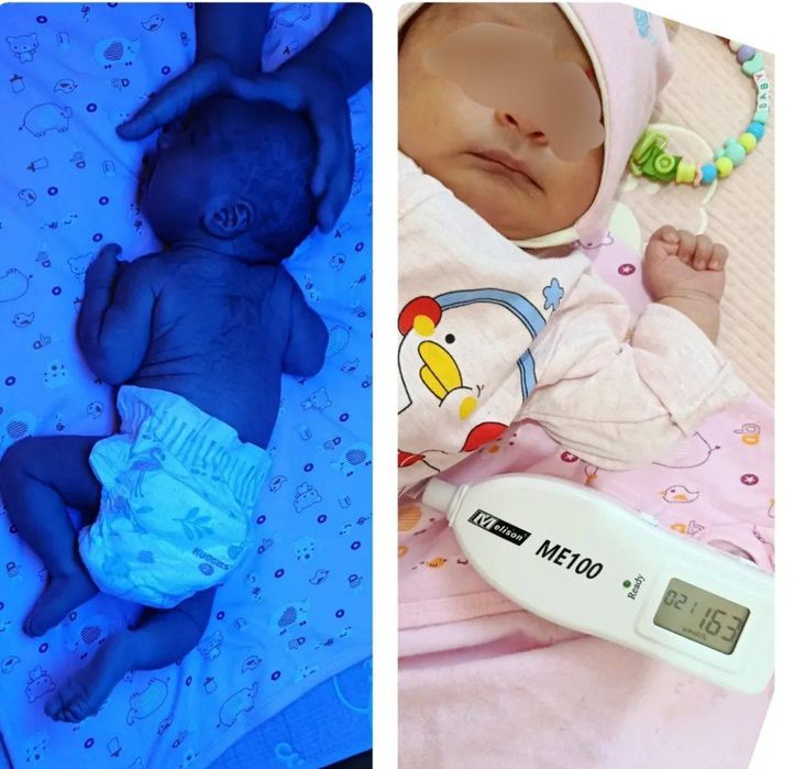 Bolada sariqlikni pasaytirivchi fototerapiya lampasi ijarasi.