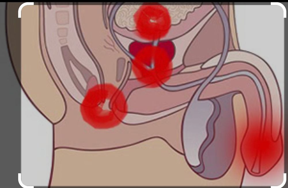 Емдік массаж. Простата массажын жасаймын