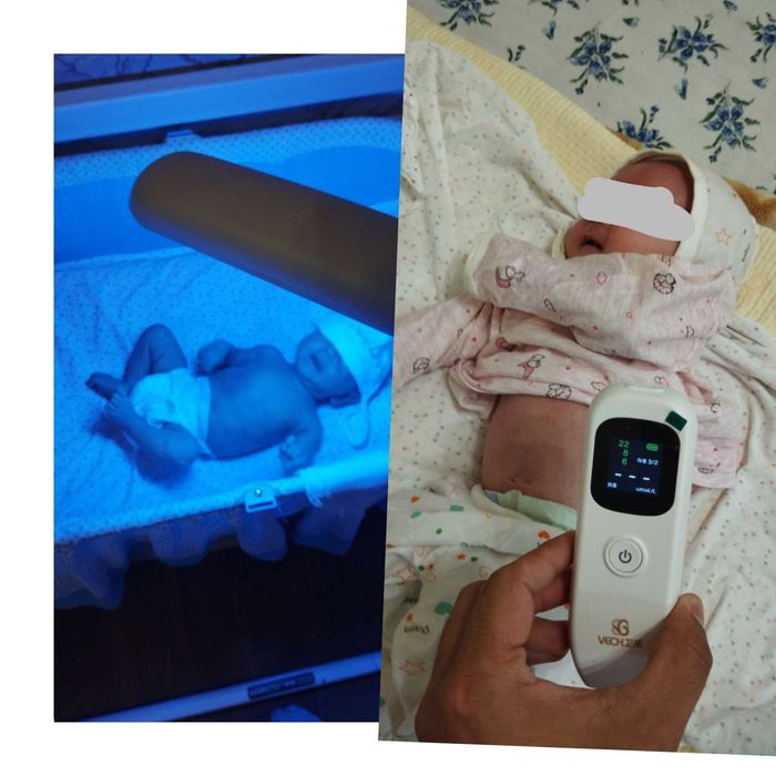 Fotolampa fototerapiya ot jeltuxi v arendu na dom